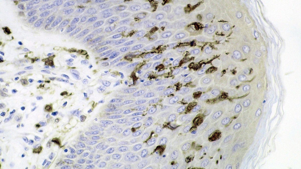 Dendritic (Langerhans) cells in epithelium shown by immunohistochemistry — the antigen-presenting cells that display peptides on MHC for self/non-self inspection, a Panacea Bio Chem review by Bogdan Dicoias