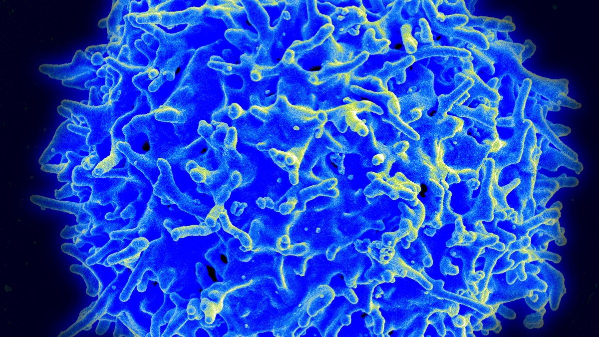 Scanning electron micrograph of a healthy human T lymphocyte — the sentinel cell of immunological self/non-self recognition, a Panacea Bio Chem review by Bogdan Dicoias